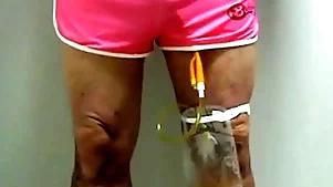 Catheter with collecting sac by pinky 396
